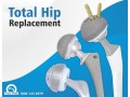 discover-top-quality-hip-replacement-implants-and-prosthesis-for-a-pain-free-life-small-0