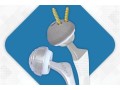 discover-top-quality-hip-replacement-implants-and-prosthesis-for-a-pain-free-life-small-1