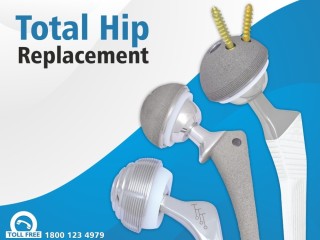 Discover Top-Quality Hip Replacement Implants and Prosthesis for a Pain-Free Life