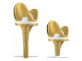 buy-top-quality-total-knee-replacement-implants-from-sharma-orthopedic-small-0