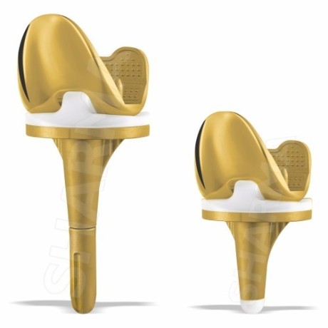 buy-top-quality-total-knee-replacement-implants-from-sharma-orthopedic-big-0