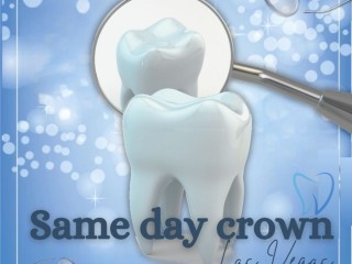 Same-Day Crowns  in Las Vegas at Functional Aesthetic Dentistry