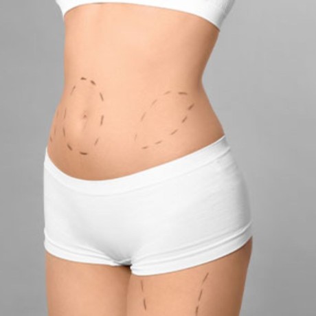 get-a-flatter-toned-abdomen-with-liposuction-360-in-maryland-aesthetic-lavcs-expert-care-big-0