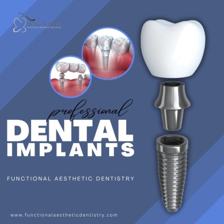 experience-superior-dental-implant-solutions-in-summerlin-at-functional-aesthetic-dentistry-big-0