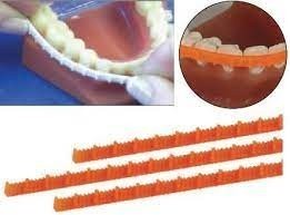 dental-elastics-big-0