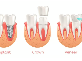 Summerlin Dental Care offers advanced laser dentistry that can transform your smile.